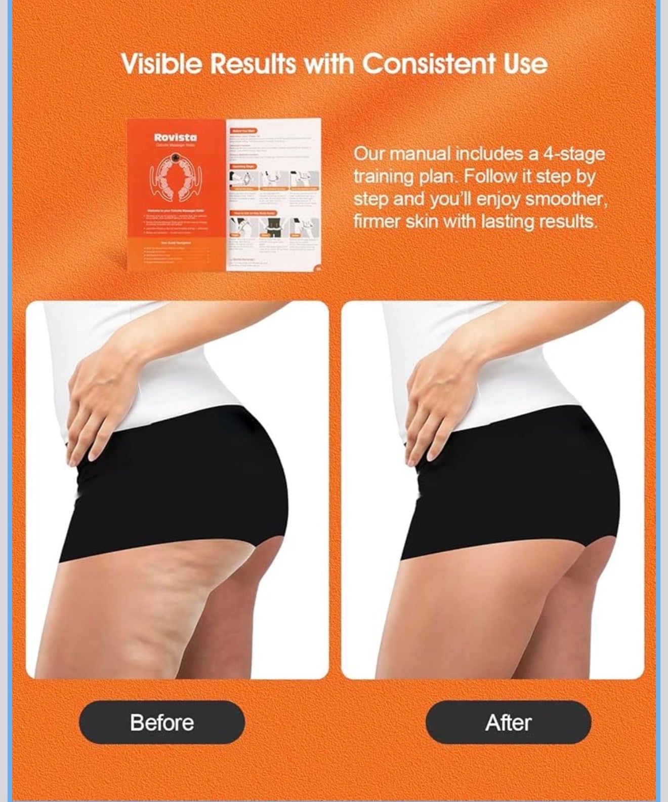 Reductor Anticelulitis 360° | Tonifica y Mejora la Piel desde Casa (Masajeador Corporal)
